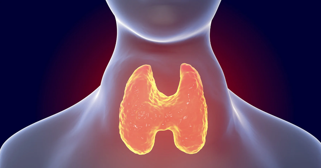 Sinh viên Đại học Bách khoa năm cuối bị basedow nhiều năm, bác sĩ hỏi vẫn không biết mình mắc bệnh gì- Ảnh 4. Sinh viên Đại học Bách khoa năm cuối bị basedow nhiều năm, bác sĩ hỏi vẫn không biết mình mắc bệnh gì- Ảnh 4.