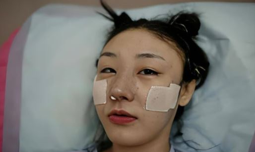 37 ca phẫu thuật, gần 30 tỷ đồng và cái kết cay đắng của người phụ nữ muốn trở thành Phạm Băng Băng thứ hai- Ảnh 1. 37 ca phẫu thuật, gần 30 tỷ đồng và cái kết cay đắng của người phụ nữ muốn trở thành Phạm Băng Băng thứ hai- Ảnh 1.