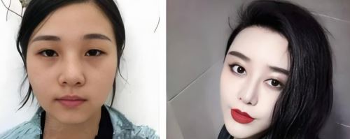 37 ca phẫu thuật, gần 30 tỷ đồng và cái kết cay đắng của người phụ nữ muốn trở thành Phạm Băng Băng thứ hai- Ảnh 2. 37 ca phẫu thuật, gần 30 tỷ đồng và cái kết cay đắng của người phụ nữ muốn trở thành Phạm Băng Băng thứ hai- Ảnh 2.