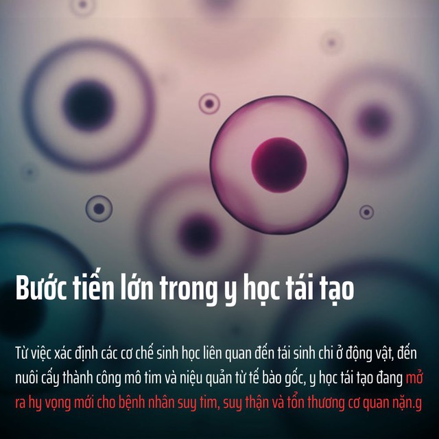 Những đột ph&aacute; y học nổi bật năm 2025: Khi khoa học kh&ocirc;ng c&ograve;n ở ph&ograve;ng th&iacute; nghiệm m&agrave; bước thẳng v&agrave;o đời sống- Ảnh 3.