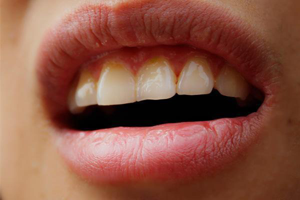 Nhận biết bệnh gan qua giấc ngủ: Những người có vấn đề về gan thường xuất hiện 3 triệu chứng vào ban đêm- Ảnh 3. Nhận biết bệnh gan qua giấc ngủ: Những người có vấn đề về gan thường xuất hiện 3 triệu chứng vào ban đêm- Ảnh 3.