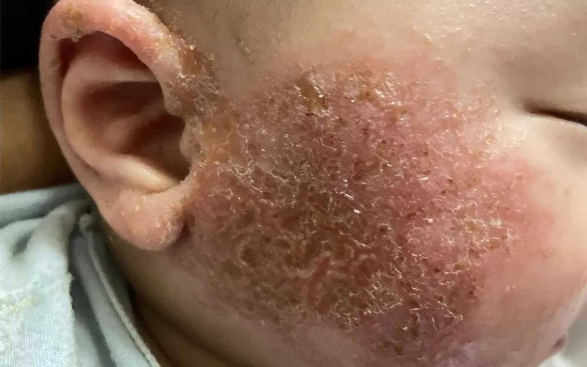 H&igrave;nh minh họa.