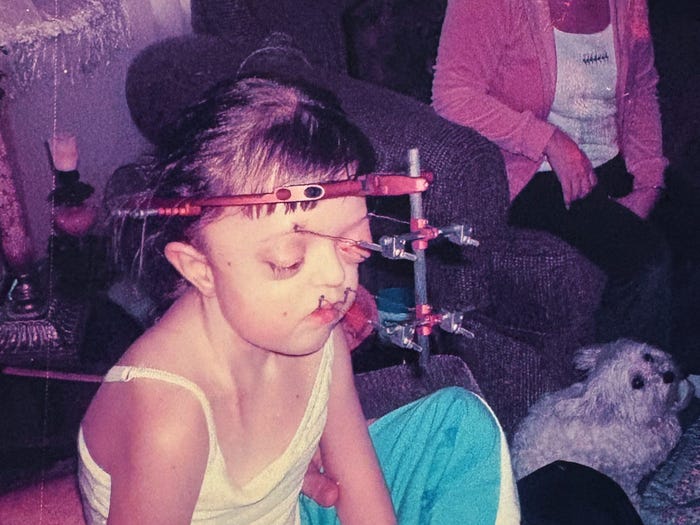 T&ocirc;i đ&atilde; che giấu khu&ocirc;n mặt suốt nhiều năm, nhưng giờ t&ocirc;i tự h&agrave;o chấp nhận vẻ kh&aacute;c biệt của ch&iacute;nh m&igrave;nh- Ảnh 4.