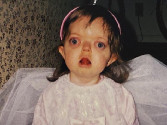 T&ocirc;i đ&atilde; che giấu khu&ocirc;n mặt suốt nhiều năm, nhưng giờ t&ocirc;i tự h&agrave;o chấp nhận vẻ kh&aacute;c biệt của ch&iacute;nh m&igrave;nh- Ảnh 3.