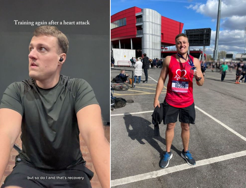 Kiểu tập gym khiến nam giới trẻ tuổi phải hối hận- Ảnh 2.