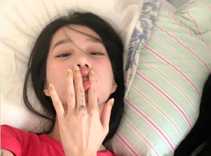 5 điều lưỡi c&oacute; thể tiết lộ về sức khỏe: Từ ung thư đến nguy cơ đột quỵ cũng hiện ra!