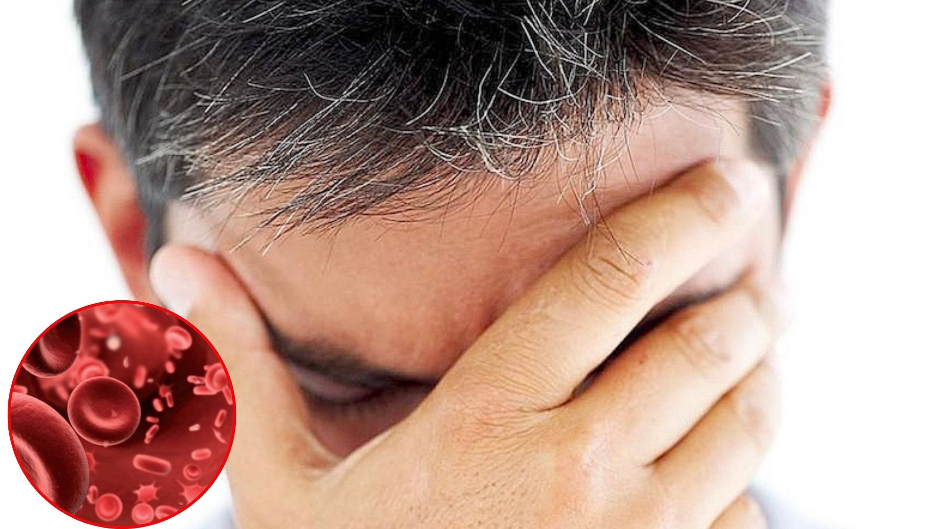 T&oacute;c bạc sớm c&oacute; phải do "m&aacute;u xấu"?- Ảnh 2.