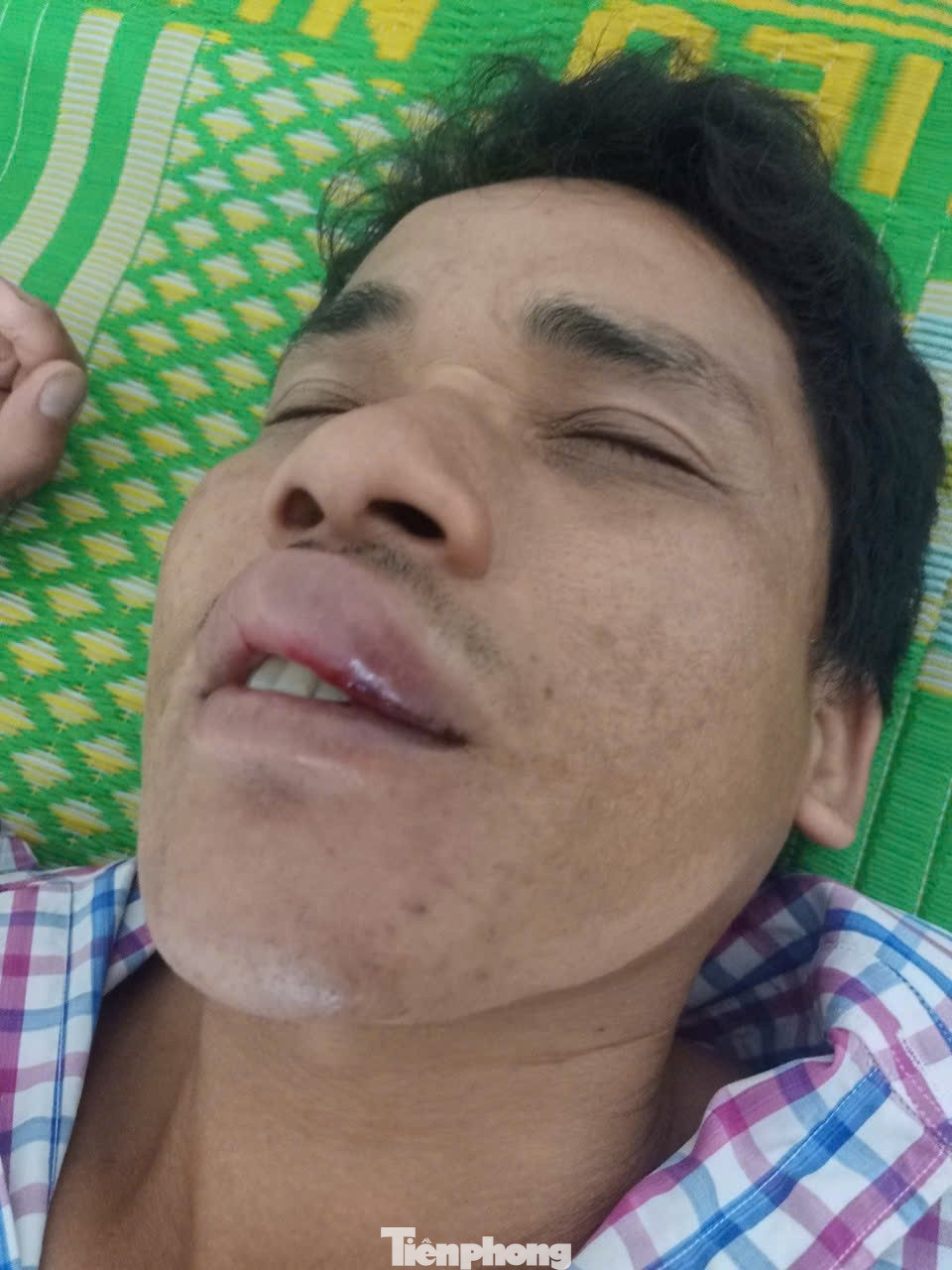 Vụ bị đ&aacute;nh đến &lsquo;th&acirc;n t&agrave;n ma dại&rsquo;, thương t&iacute;ch 0%': Dấu hỏi nguy&ecirc;n nh&acirc;n khiến nạn nh&acirc;n yếu liệt tứ chi?- Ảnh 3.