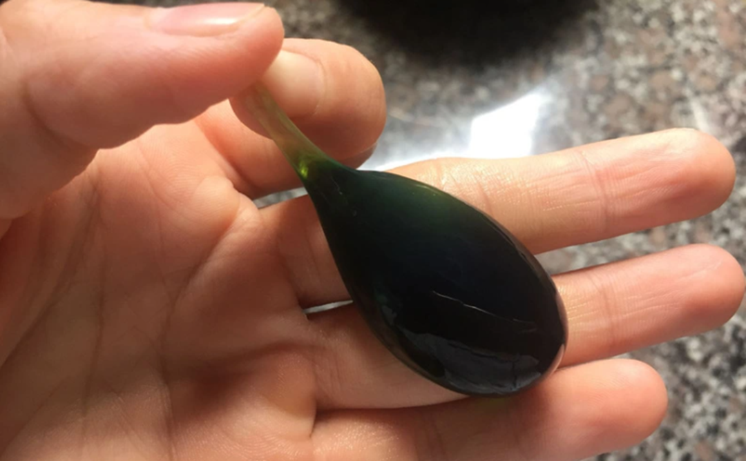 Người đàn ông 38 tuổi suýt chết vì nuốt mật cá trắm để "tăng cường sinh lực"- Ảnh 1.