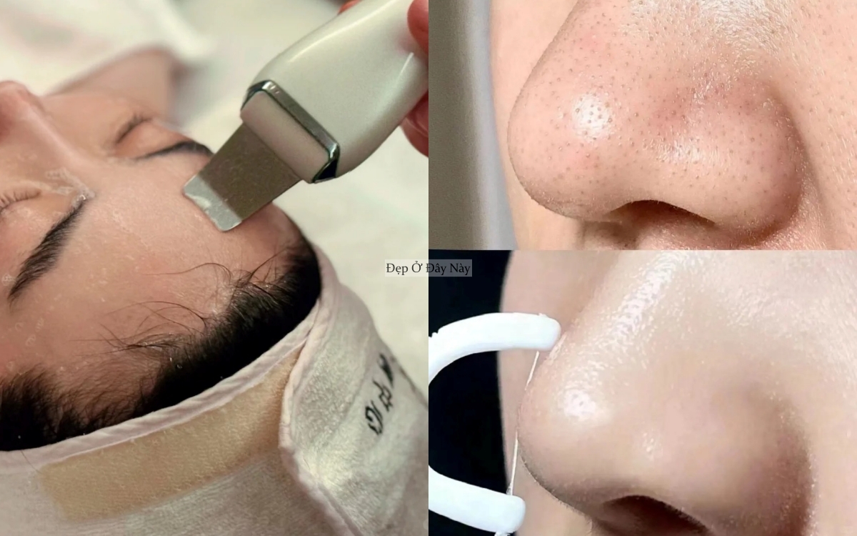 Dưỡng ngo&agrave;i th&ocirc;i l&agrave; chưa đủ, phụ nữ H&agrave;n d&ugrave;ng 4 loại m&aacute;y n&agrave;y để da đẹp tận lỗ ch&acirc;n l&ocirc;ng- Ảnh 5.