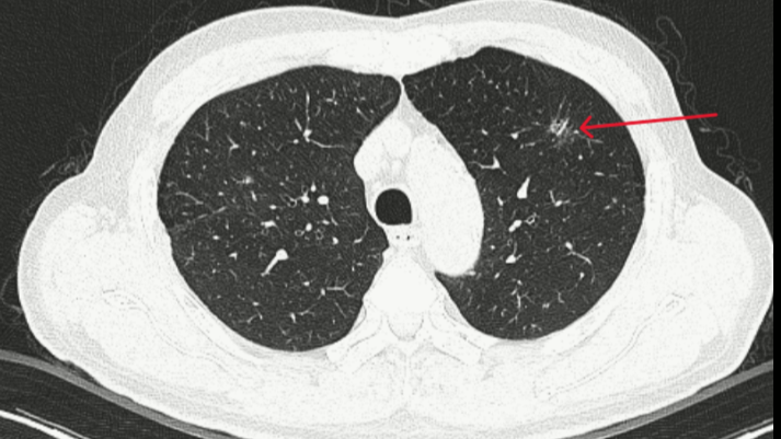 AI - 'con mắt thứ ba' gi&uacute;p b&aacute;c sĩ ph&aacute;t hiện sớm ung thư từ dấu hiệu nhỏ- Ảnh 3.
