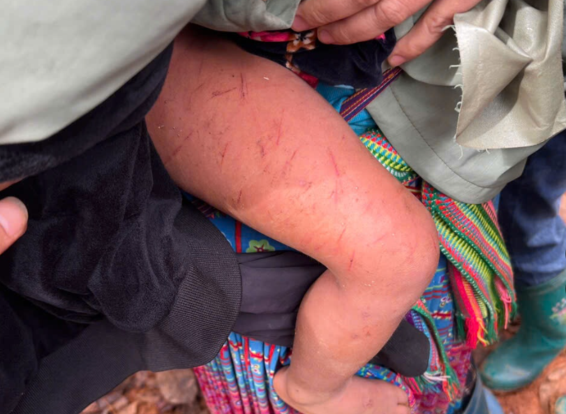 Lạc giữa rừng suốt 15 tiếng mưa r&eacute;t, b&eacute; trai 4 tuổi ở Lai Ch&acirc;u được t&igrave;m thấy trong t&igrave;nh trạng khiến ai cũng x&oacute;t xa- Ảnh 2.