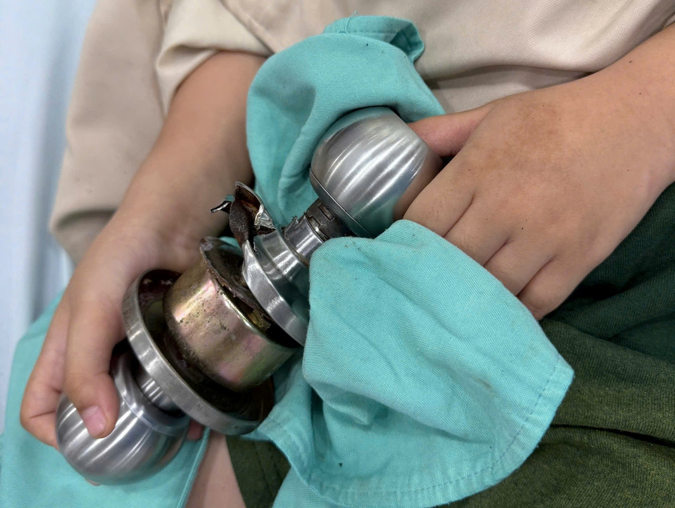 Bệnh nhi &lsquo;&ocirc;m&rsquo; ổ kh&oacute;a nhập viện cấp cứu, b&aacute;c sĩ ph&aacute;t cảnh b&aacute;o khẩn- Ảnh 1.