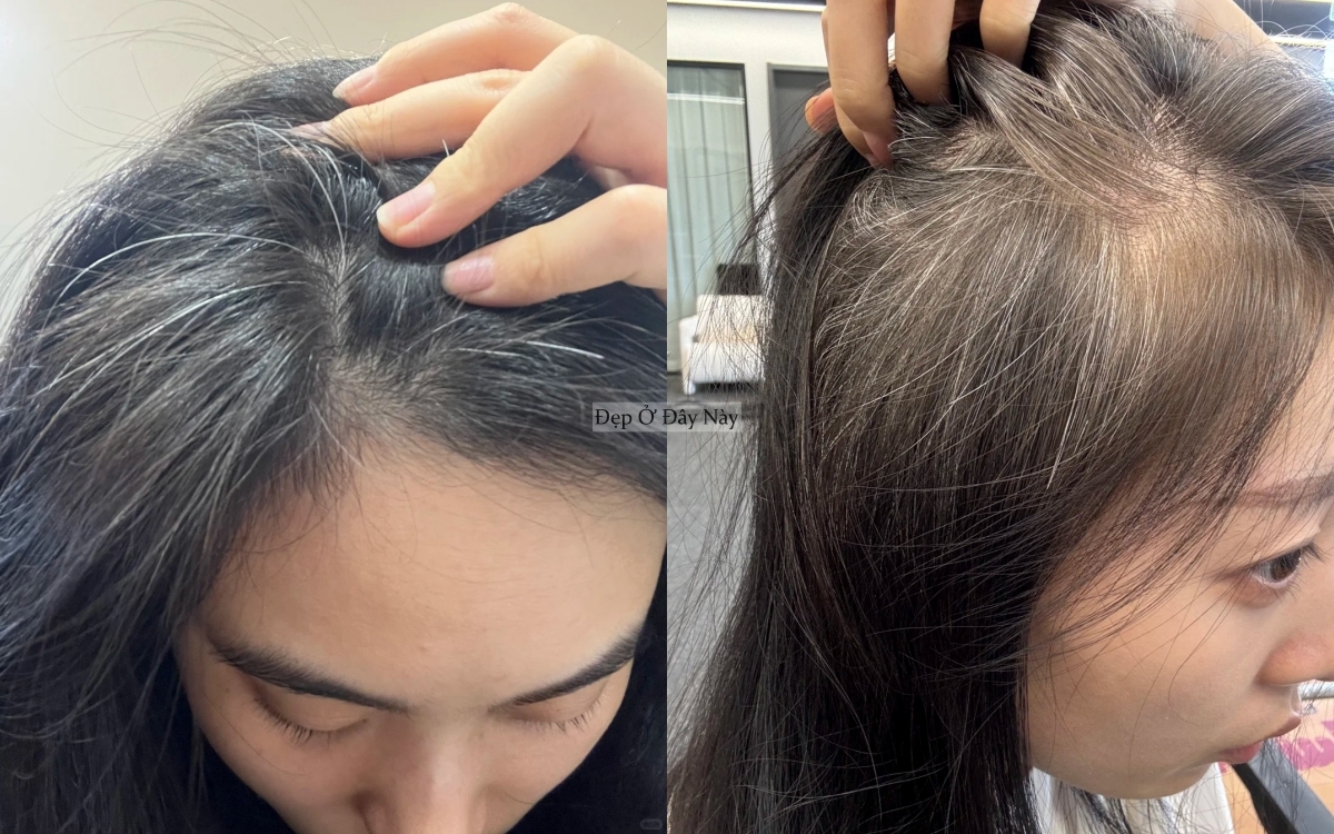 V&igrave; sao phụ nữ trung ni&ecirc;n kh&ocirc;ng n&ecirc;n nhổ t&oacute;c bạc?- Ảnh 2.