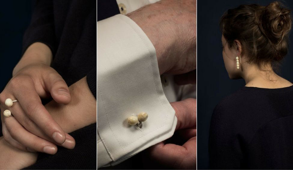 C&ocirc; g&aacute;i chuy&ecirc;n thu mua răng người- Ảnh 2.