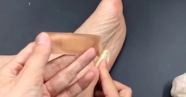 Người phụ nữ 56 tuổi dán tỏi vào lòng bàn chân suốt 6 tháng, kết quả khám sức khỏe khiến bác sĩ 