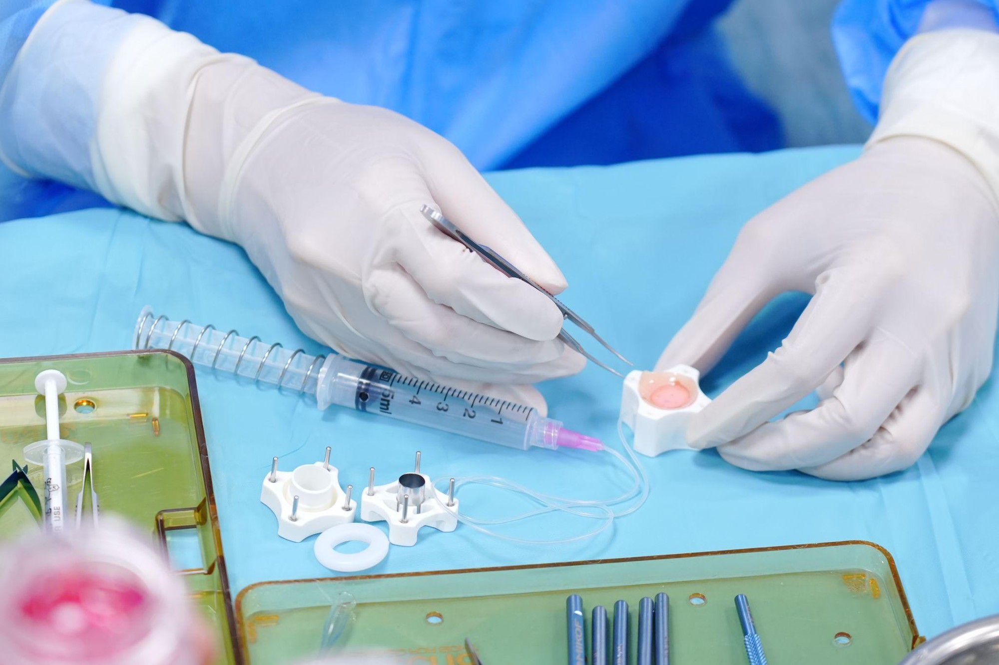 Sáng chế của nữ bác sĩ Việt tạo bước tiến mới trong ghép giác mạc- Ảnh 1. Sáng chế của nữ bác sĩ Việt tạo bước tiến mới trong ghép giác mạc- Ảnh 1.