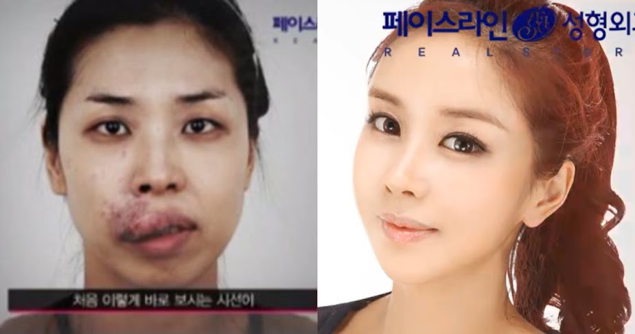 Cô gái vô danh khiến cả showbiz sững sờ với màn 