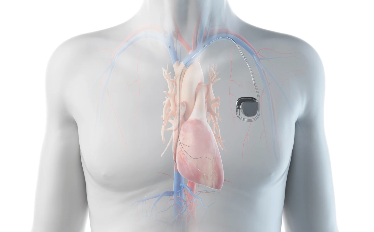 Ch&agrave;ng trai ở TPHCM mắc bệnh hiếm, 100.000 người chỉ c&oacute; 2 người mắc- Ảnh 1.