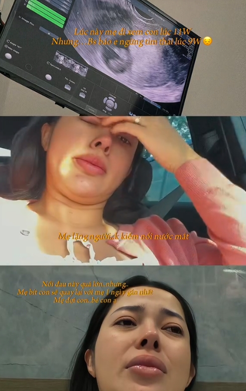 Nữ TikToker nổi tiếng th&ocirc;ng b&aacute;o 