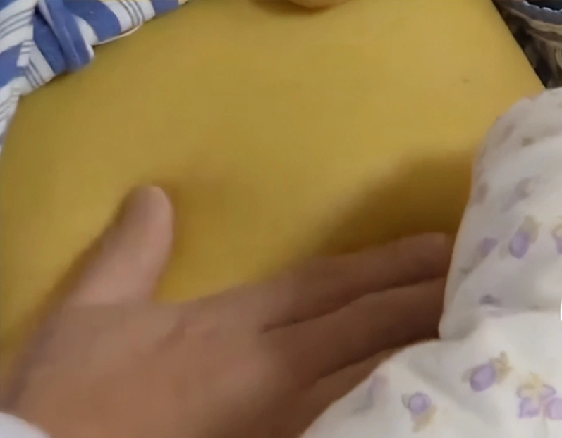 Nữ sinh 20 tuổi suy gan, da v&agrave;ng như nghệ v&igrave; chăm da theo c&aacute;ch của nhiều người- Ảnh 1.