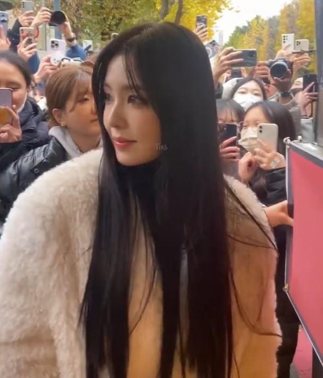 Kh&oacute; tin nhất l&uacute;c n&agrave;y l&agrave; l&agrave;n da của Irene- Ảnh 9.