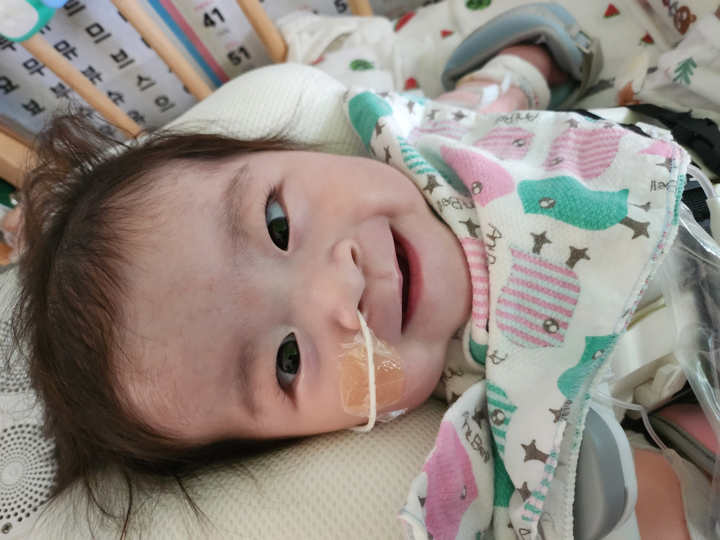 H&agrave;n Quốc điều trị th&agrave;nh c&ocirc;ng cho trẻ sơ sinh mắc chứng tim lạc chỗ- Ảnh 2.