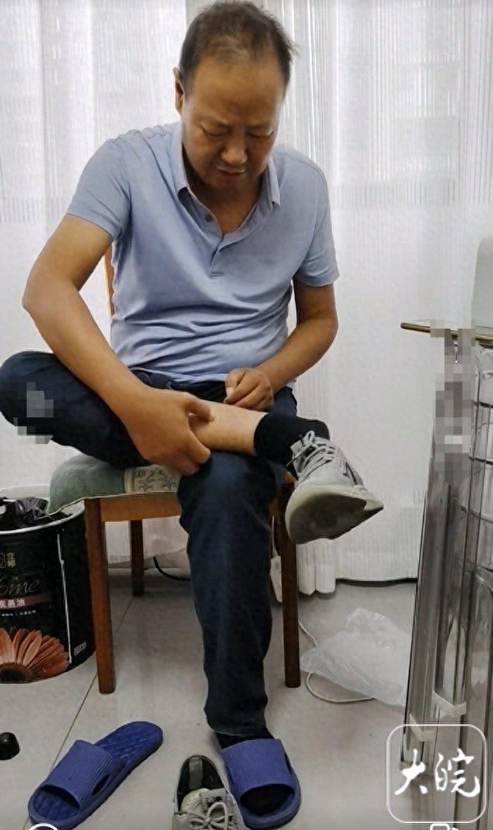 Gi&aacute;o vi&ecirc;n suy thận giai đoạn cuối: 10 năm lọc m&agrave;ng bụng 4 lần/ng&agrave;y, đi gi&agrave;y ngoại cỡ để l&ecirc;n lớp- Ảnh 1.