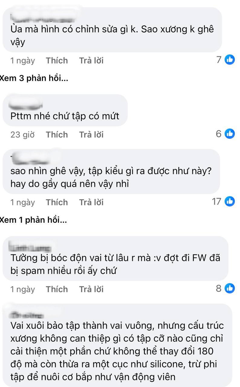 Cam thường lộ vai dị dạng của mỹ nh&acirc;n 4000 năm c&oacute; một- Ảnh 7.