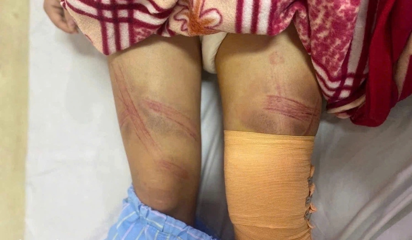 Vụ b&eacute; g&aacute;i lớp 7 bị bố đ&aacute;nh nhập viện ở Nghệ An: Nguồn cơn từ con lợn đất?- Ảnh 1.