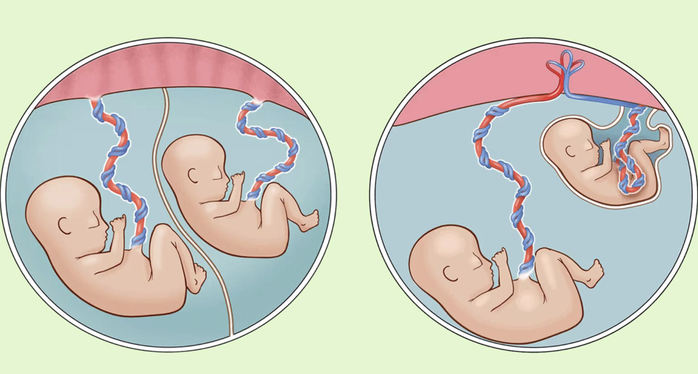 B&eacute; trai nặng chưa đầy 1 kg được cứu sống thần kỳ- Ảnh 1.