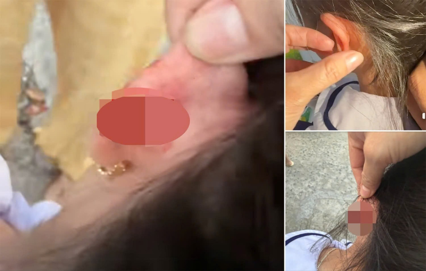 X&aacute;c minh vụ gi&aacute;o vi&ecirc;n tiểu học v&eacute;o tai học sinh lớp 1 chảy m&aacute;u ở Ph&uacute; Quốc- Ảnh 1.