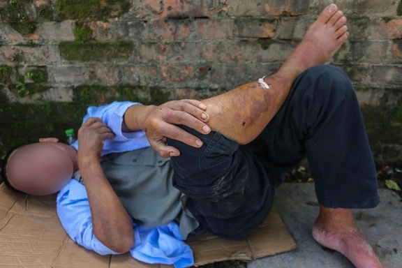 Người đ&agrave;n &ocirc;ng ở Huế bị nh&oacute;m học sinh đ&aacute;nh đập: Ho&agrave;n cảnh đ&aacute;ng thương, vẫn c&ograve;n sợ h&atilde;i- Ảnh 1.