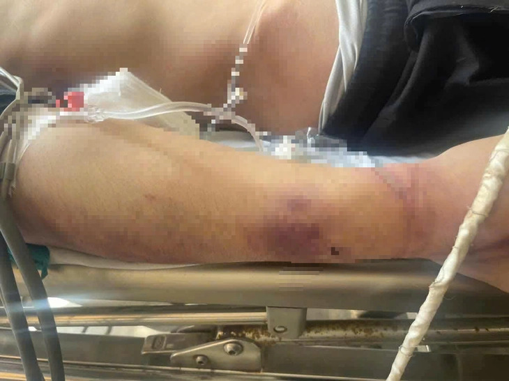 Một học vi&ecirc;n 17 tuổi tử vong sau vụ x&ocirc; x&aacute;t tại trung t&acirc;m c&ocirc;ng t&aacute;c x&atilde; hội- Ảnh 2.