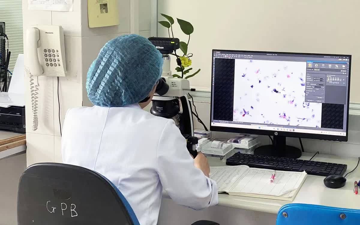 H&igrave;nh minh họa.