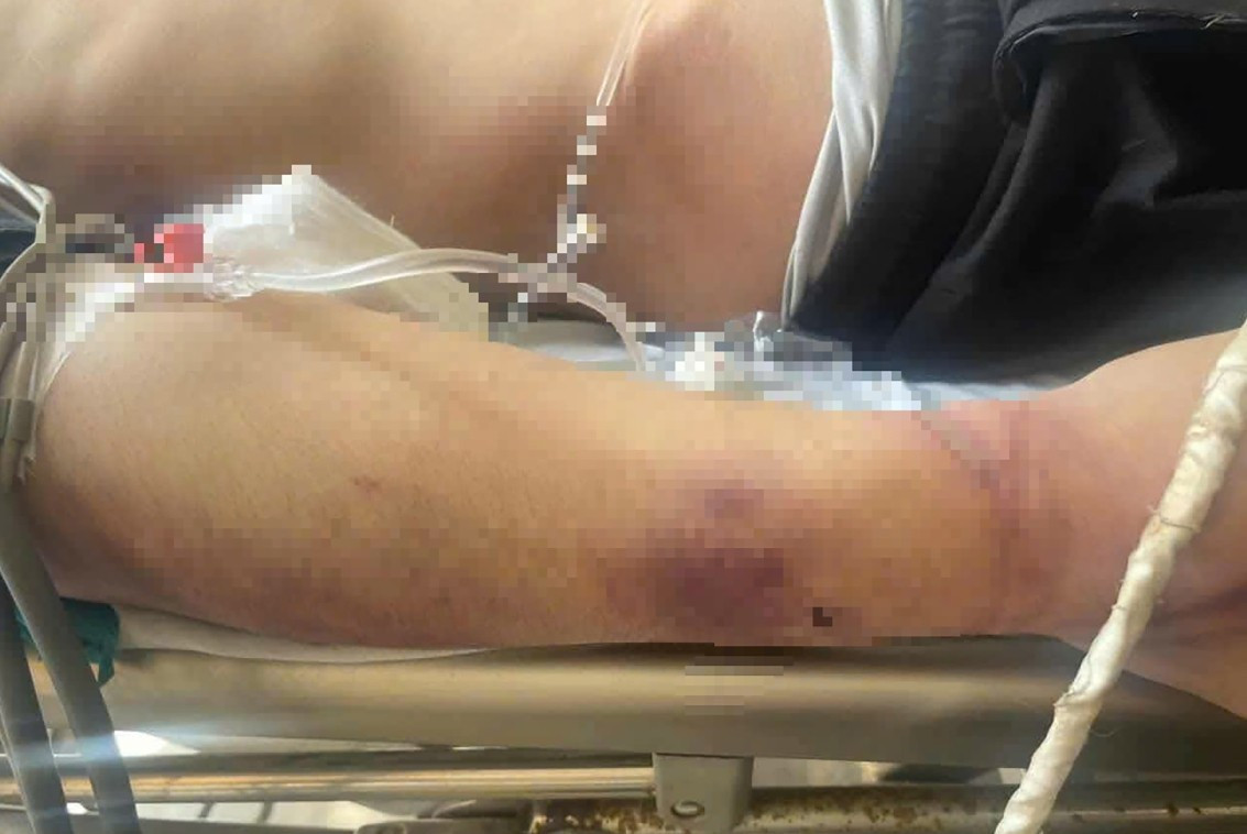 Nam sinh tử vong sau 2 ng&agrave;y nhập học tại Trung t&acirc;m c&ocirc;ng t&aacute;c x&atilde; hội- Ảnh 2.