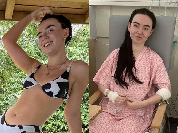 "B&aacute;c sĩ n&oacute;i t&ocirc;i chỉ c&ograve;n 48 giờ để sống" - C&ocirc; g&aacute;i 25 tuổi kh&ocirc;ng ngờ m&igrave;nh su&yacute;t mất mạng v&igrave; bỏ qua những dấu hiệu tưởng b&igrave;nh thường- Ảnh 1.