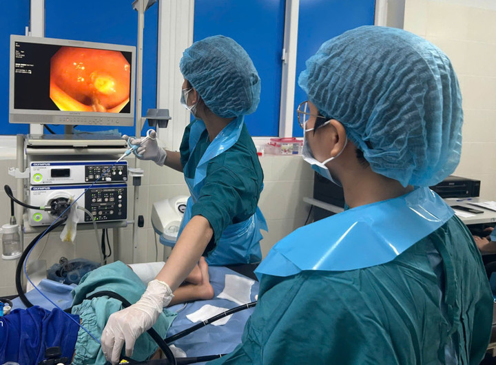 B&eacute; 6 tuổi mắc 4 khối polyp đại tr&agrave;ng- Ảnh 1.