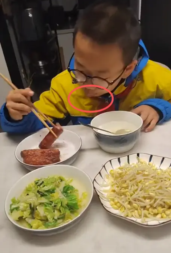 Bức ảnh ăn s&aacute;ng khiến cư d&acirc;n mạng tranh c&atilde;i: Nh&igrave;n m&ocirc;i đứa trẻ đi bố mẹ ơi, đang c&oacute; vấn đề k&igrave;a!- Ảnh 1.