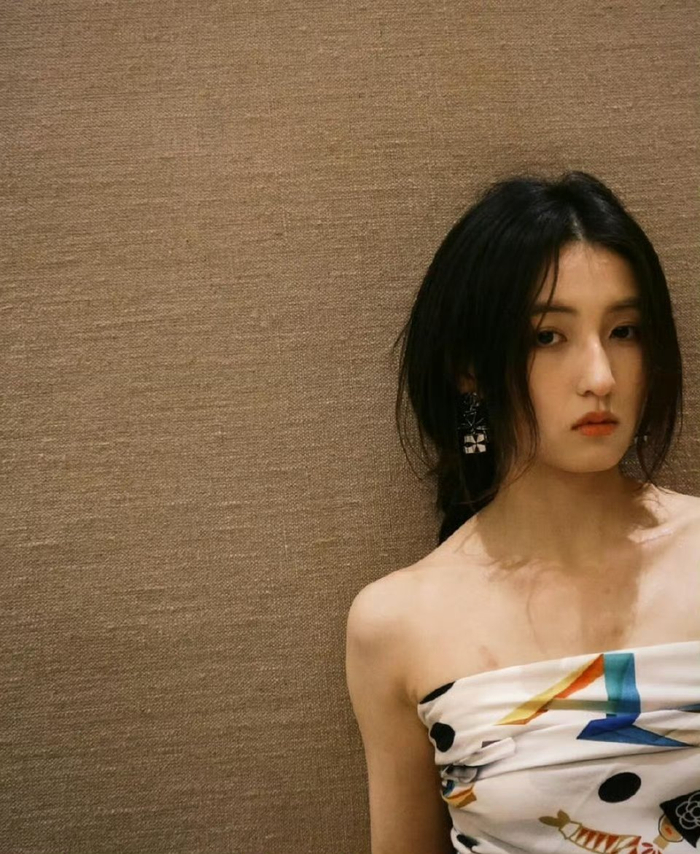 Sao nữ gen Z lộ vết bầm bất thường tr&ecirc;n ngực v&agrave; c&aacute;nh tay- Ảnh 1.