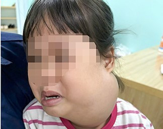 48 giờ sinh tử của b&eacute; g&aacute;i 2 tuổi c&oacute; khối u khổng lồ- Ảnh 2.