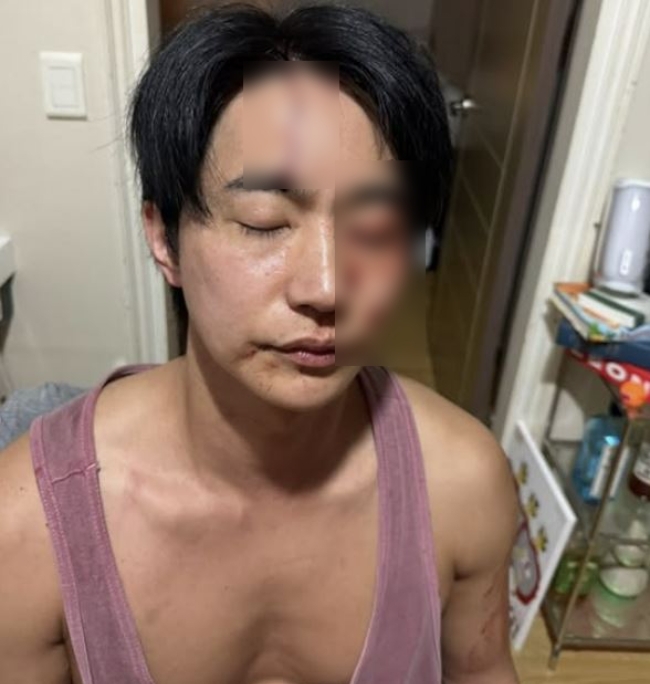 C&ocirc;ng bố kết quả điều tra vụ nam diễn vi&ecirc;n ngoan hiền bị tố đ&aacute;nh đập, &ldquo;đ&agrave;o mỏ&rdquo; bạn g&aacute;i h&agrave;ng trăm triệu- Ảnh 4.