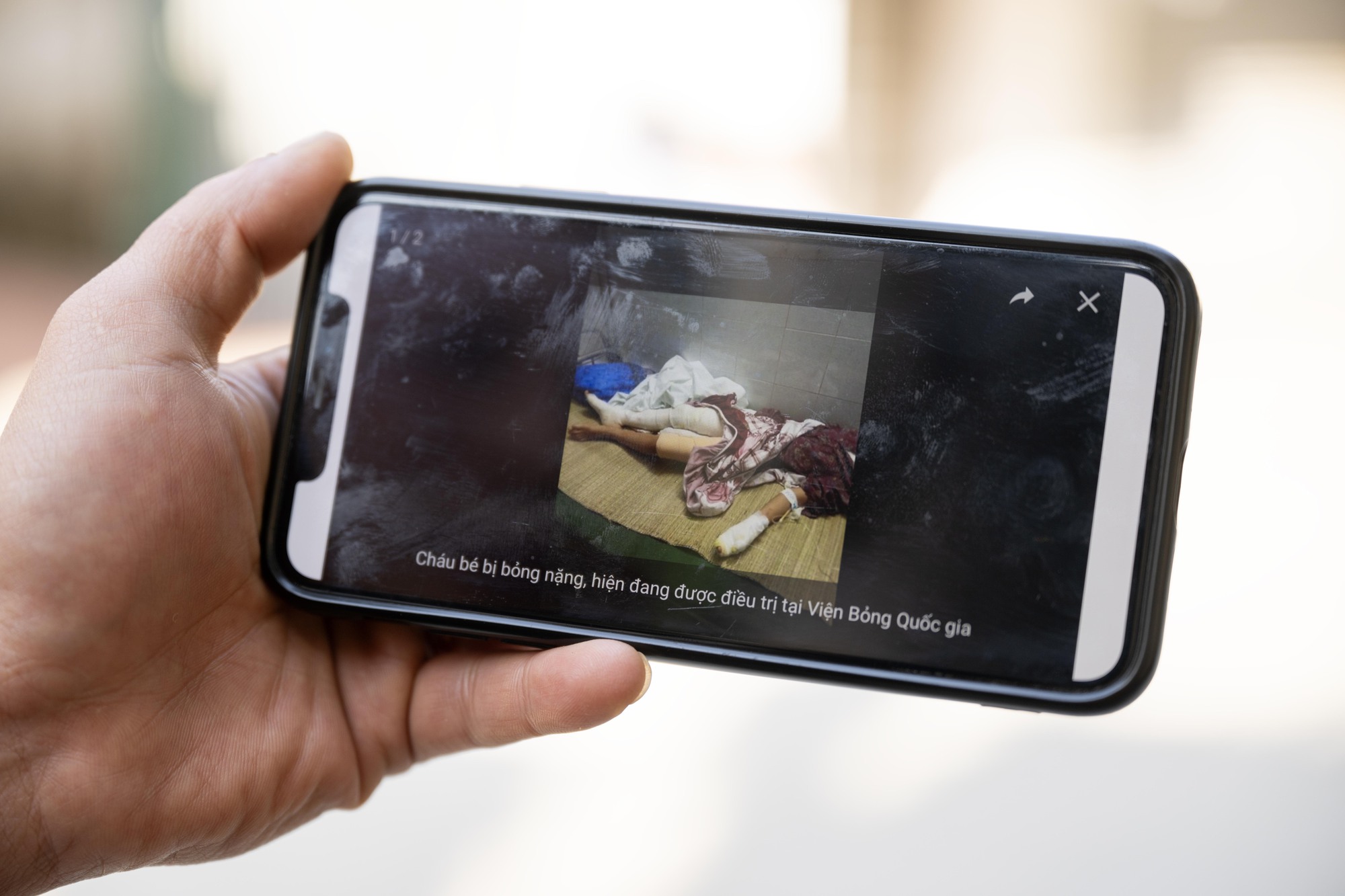 Vụ thả ch&oacute; dữ cắn người phụ nữ ở H&agrave; Nội: Nh&acirc;n chứng kể lại ph&uacute;t kinh ho&agrave;ng v&agrave; qu&aacute; khứ "bất hảo" của kẻ g&acirc;y sự- Ảnh 4.