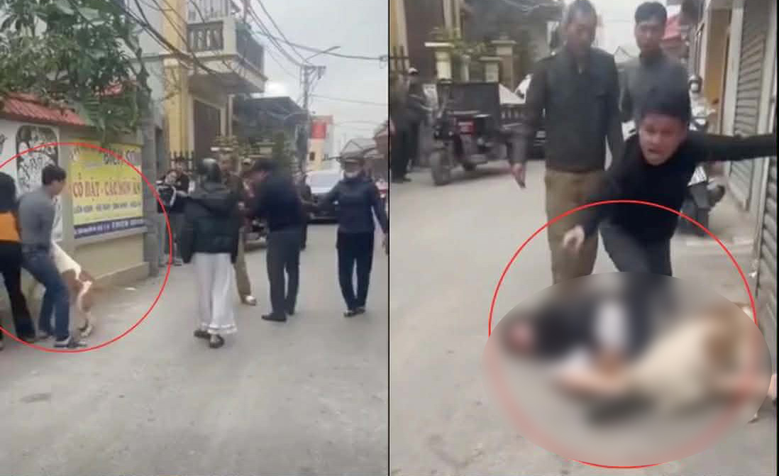 Vụ thả ch&oacute; cắn người nhập viện ở H&agrave; Nội: Nạn nh&acirc;n kể chi tiết- Ảnh 2.