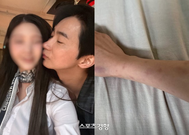 C&ocirc;ng bố kết quả điều tra vụ nam diễn vi&ecirc;n ngoan hiền bị tố đ&aacute;nh đập, &ldquo;đ&agrave;o mỏ&rdquo; bạn g&aacute;i h&agrave;ng trăm triệu- Ảnh 3.