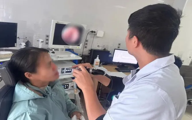 Cảnh gi&aacute;c với vi&ecirc;m nấm xoang mũi- Ảnh 1.