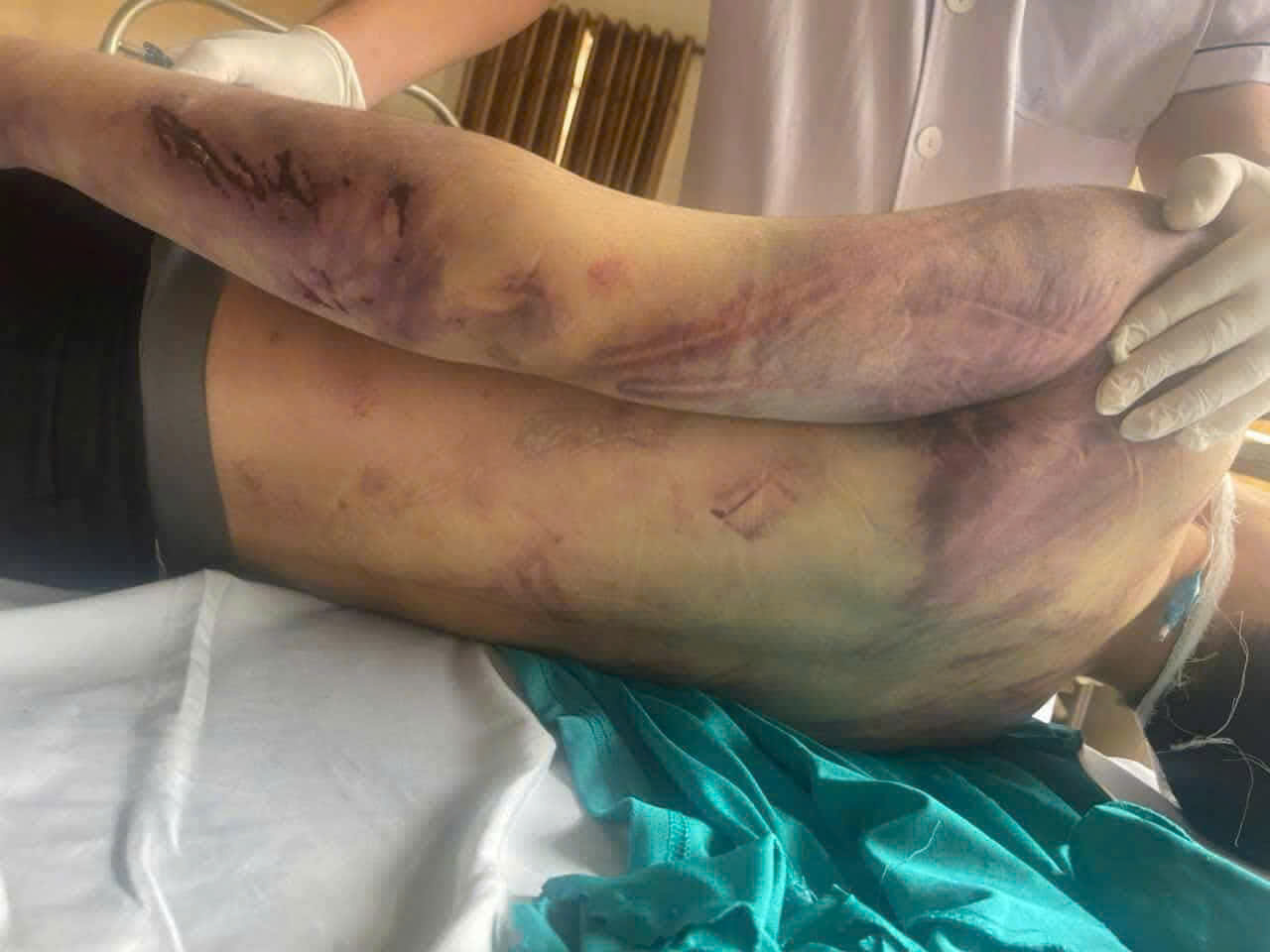 Tạm giữ 8 người li&ecirc;n quan đến vụ học vi&ecirc;n 17 tuổi tử vong tại trung t&acirc;m c&ocirc;ng t&aacute;c x&atilde; hội- Ảnh 1.