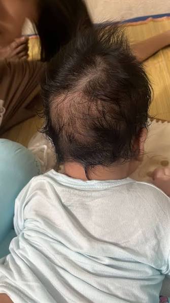 Theo quan niệm d&acirc;n gian những đứa trẻ c&oacute; "đu&ocirc;i dế" thường kh&oacute; nu&ocirc;i, nhưng kh&ocirc;ng phải chỉ c&oacute; như vậy- Ảnh 2.