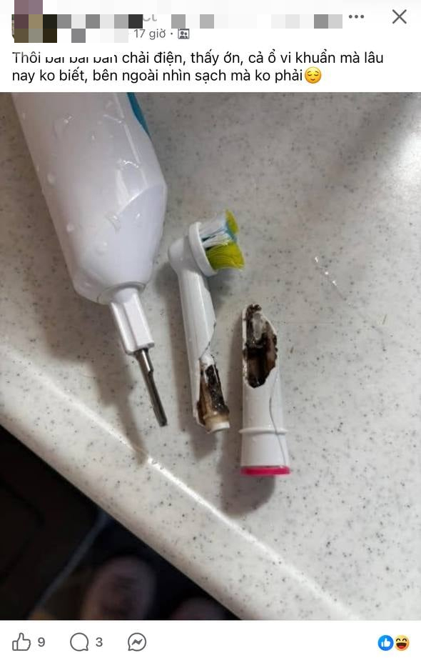 Cận cảnh thứ b&ecirc;n trong b&agrave;n chải điện khiến nhiều người r&ugrave;ng m&igrave;nh: BS n&oacute;i g&igrave;?- Ảnh 1.