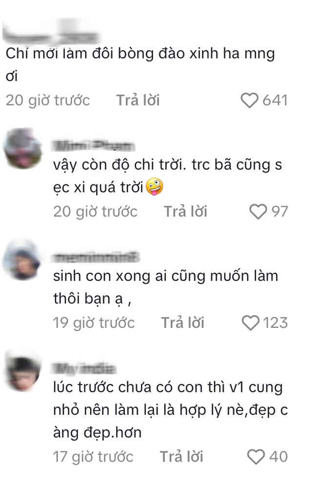 Bảo Anh mới thẩm mỹ?- Ảnh 4.